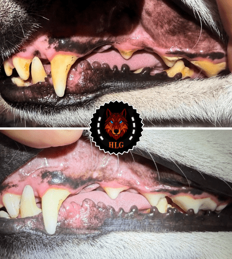 Ultrasound Teeth Cleaning