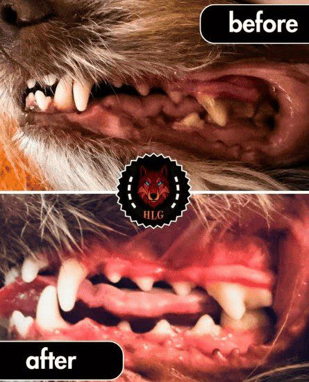 Before and after of the ultrasound teeth cleaning